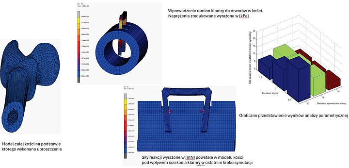 Analiza własności implantów medycznych wykonanych z materiałów z pamięcią kształtu
